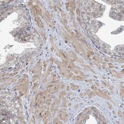 Immunohistochemistry-Paraffin: SBF2 Antibody [NBP2-13283]