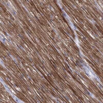 Immunohistochemistry-Paraffin: SBK2 Antibody [NBP1-91020]