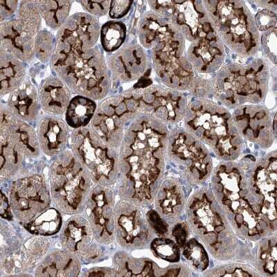 Immunohistochemistry-Paraffin: SBK2 Antibody [NBP1-91020]
