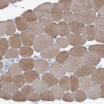 Immunohistochemistry-Paraffin: SBK2 Antibody [NBP1-91020]