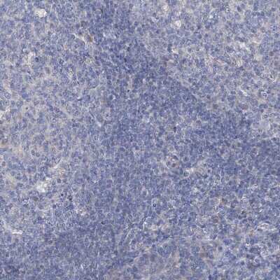 Immunohistochemistry-Paraffin: SBK2 Antibody [NBP1-91020]