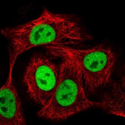 Immunocytochemistry/ Immunofluorescence: SBNO1 Antibody [NBP1-83837]