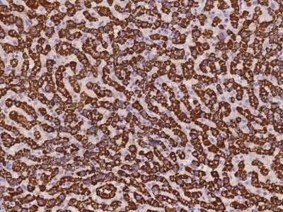 Immunohistochemistry-Paraffin: SBNO2 Antibody [NBP3-06312]