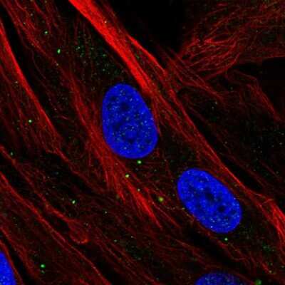 Immunocytochemistry/ Immunofluorescence: SBSN Antibody [NBP2-49528]