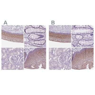 Immunohistochemistry-Paraffin: SBSN Antibody [NBP2-49369]