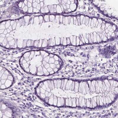 Immunohistochemistry-Paraffin: SBSN Antibody [NBP2-49528]