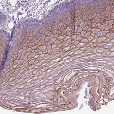 Immunohistochemistry-Paraffin: SBSN Antibody [NBP2-49528]