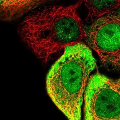 Immunocytochemistry/ Immunofluorescence: SC5DL Antibody [NBP2-55973]