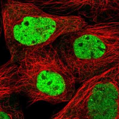 Immunocytochemistry/ Immunofluorescence: SCAF11/SFRS2IP Antibody [NBP2-55306]