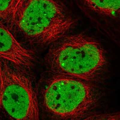 Immunocytochemistry/ Immunofluorescence: SCAF11/SFRS2IP Antibody [NBP2-55598]
