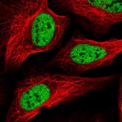 Immunocytochemistry/ Immunofluorescence: SCAF8/RBM16 Antibody [NBP2-34015]