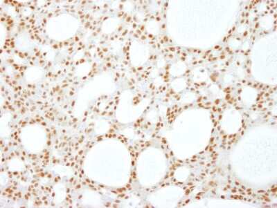Immunohistochemistry: SCAF8/RBM16 Antibody [NB100-55330]