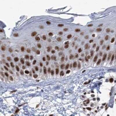 Immunohistochemistry: SCAF8/RBM16 Antibody [NBP2-34015]