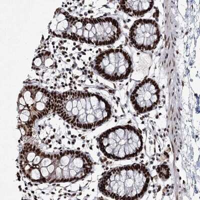 Immunohistochemistry-Paraffin: SCAF8/RBM16 Antibody [NBP1-87386]