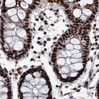 Immunohistochemistry-Paraffin: SCAF8/RBM16 Antibody [NBP1-87386]