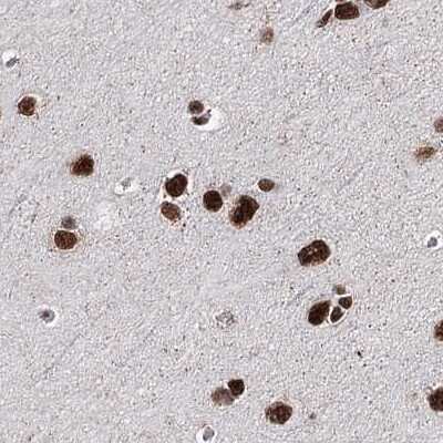Immunohistochemistry-Paraffin: SCAF8/RBM16 Antibody [NBP1-87386]