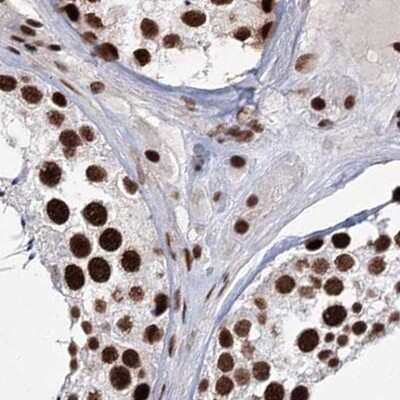 Immunohistochemistry-Paraffin: SCAF8/RBM16 Antibody [NBP1-87386]
