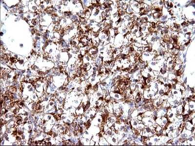 Immunohistochemistry: SCAMP2 Antibody (OTI1H10) [NBP2-45688]