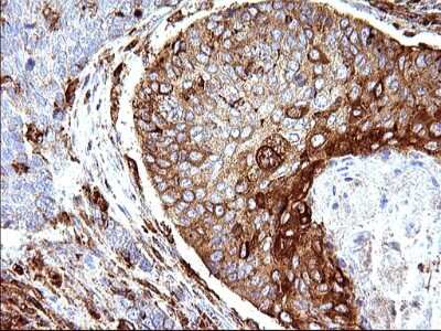 Immunohistochemistry: SCAMP2 Antibody (OTI1H10) [NBP2-45688]