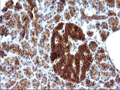Immunohistochemistry: SCAMP2 Antibody (OTI1H10) [NBP2-45688]