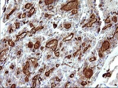 Immunohistochemistry: SCAMP2 Antibody (OTI1H10) [NBP2-45688]
