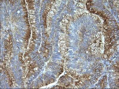 Immunohistochemistry: SCAMP2 Antibody (OTI1H10) [NBP2-45688]