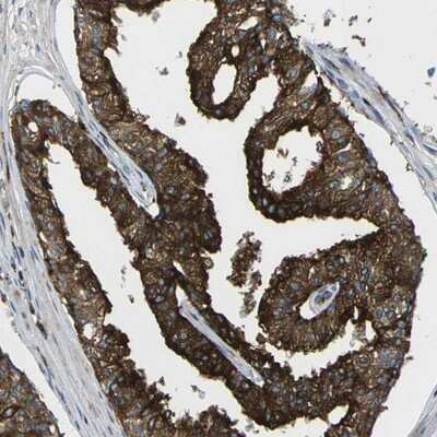 Immunohistochemistry-Paraffin: SCAMP2 Antibody [NBP1-89552]