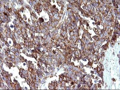 Immunohistochemistry: SCAMP2 Antibody (OTI1H10) - Azide and BSA Free [NBP2-73999]