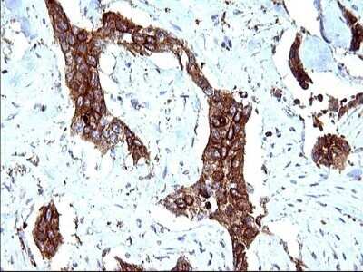 Immunohistochemistry: SCAMP2 Antibody (OTI1H10) - Azide and BSA Free [NBP2-73999]