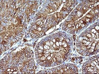Immunohistochemistry: SCAMP2 Antibody (OTI1H10) - Azide and BSA Free [NBP2-73999]