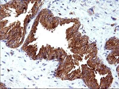 Immunohistochemistry: SCAMP2 Antibody (OTI1H10) - Azide and BSA Free [NBP2-73999]