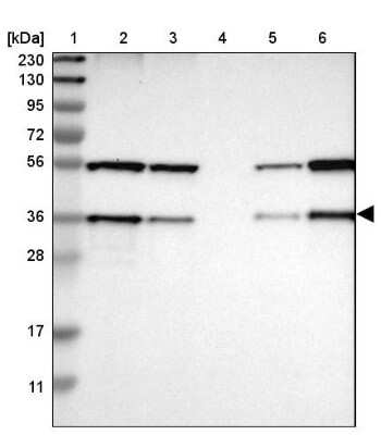 Western Blot: SCAMP2 Antibody [NBP1-89552]