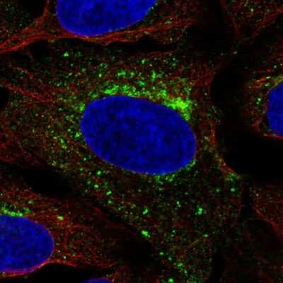 Immunocytochemistry/ Immunofluorescence: SCAMP3 Antibody [NBP2-56966]