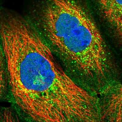 Immunocytochemistry/ Immunofluorescence: SCAMP4 Antibody [NBP1-93849]