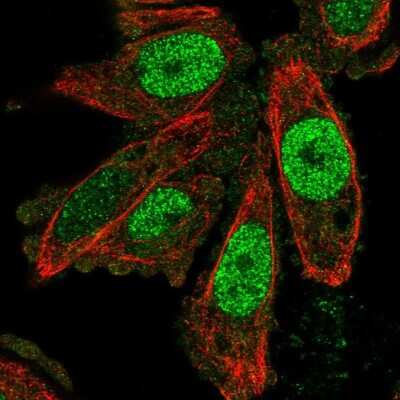 Immunocytochemistry/ Immunofluorescence: SCAND1 Antibody [NBP2-56092]