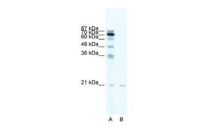 Western Blot: SCAND1 Antibody [NBP2-85693]