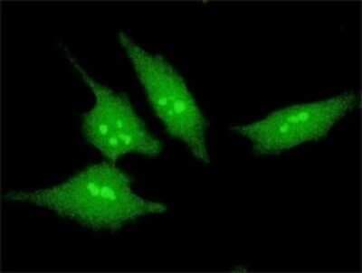 Immunocytochemistry/ Immunofluorescence: SCAND2 Antibody (5F1) [H00054581-M02]