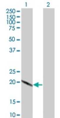 Western Blot: SCAND2 Antibody (5F1) [H00054581-M02]