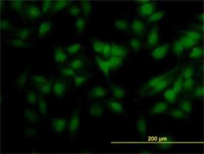 Immunocytochemistry/ Immunofluorescence: SCAND2 Antibody (7B12) [H00054581-M01]