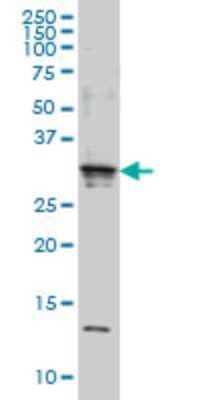 Western Blot: SCAND2 Antibody (7B12) [H00054581-M01]