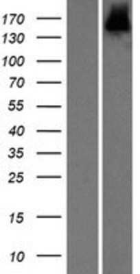 Western Blot: SCAND3 Overexpression Lysate [NBP2-05836]