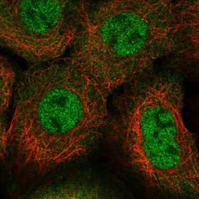 Immunocytochemistry/ Immunofluorescence: SCAP2 Antibody [NBP2-47289]