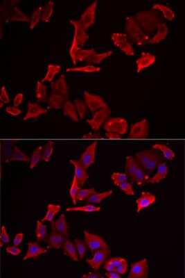 Immunocytochemistry/ Immunofluorescence: SCAP2 Antibody - BSA Free [NBP2-93556]