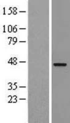 Western Blot: SCAP2 Overexpression Lysate [NBL1-15988]