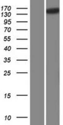 Western Blot: SCAPER Overexpression Lysate [NBP2-10240]