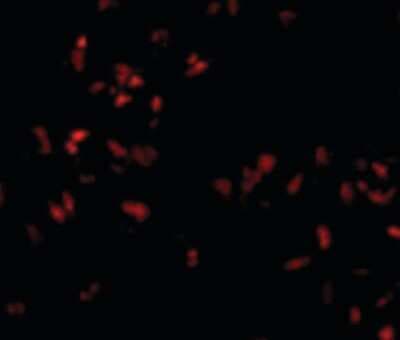 Immunocytochemistry/ Immunofluorescence: SCARA5 Antibody - BSA Free [NBP1-72121]
