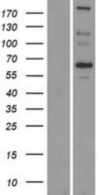 Western Blot: SCARA5 Overexpression Lysate [NBP2-05108]