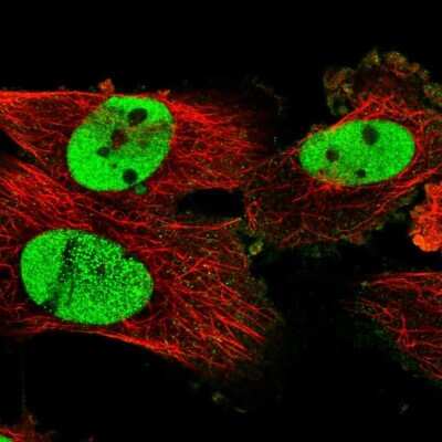 Immunocytochemistry/ Immunofluorescence: SCC112 Antibody [NBP1-87904]