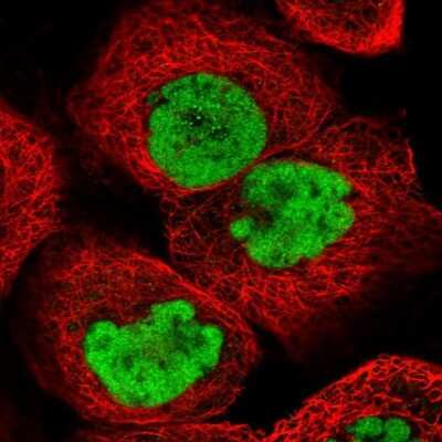 Immunocytochemistry/ Immunofluorescence: SCC112 Antibody [NBP2-38313]