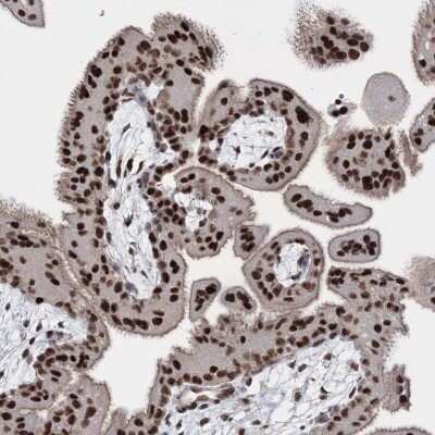Immunohistochemistry: SCC112 Antibody [NBP2-38313]